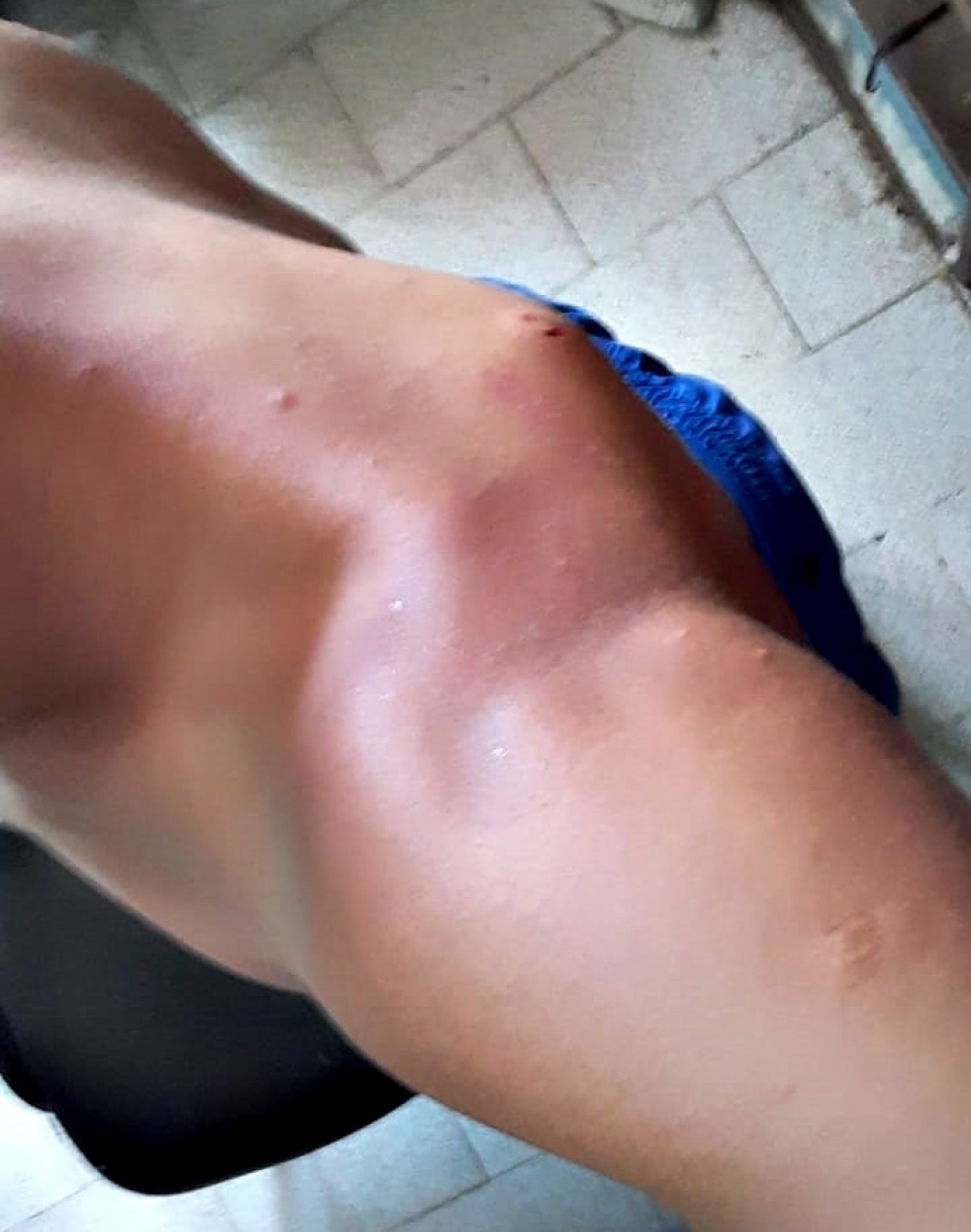 VIOLENCIA INSTITUCIONAL: JOVEN DE 22 AÑOS DENUNCIÓ HABER SIDO GOLPEADO BRUTALMENTE EN LA COMISARÍA LOCAL