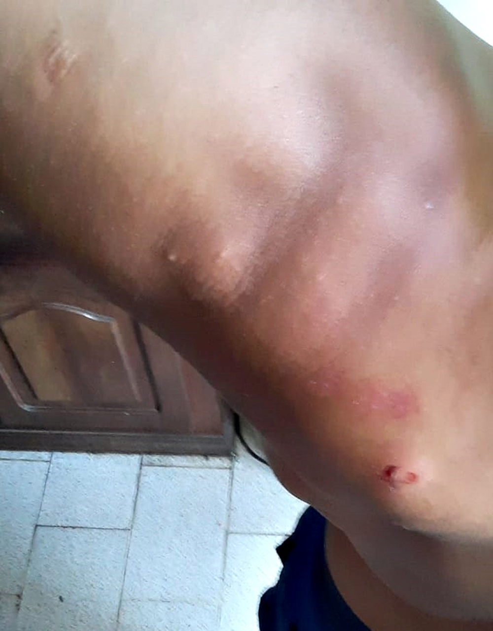 VIOLENCIA INSTITUCIONAL: JOVEN DE 22 AÑOS DENUNCIÓ HABER SIDO GOLPEADO BRUTALMENTE EN LA COMISARÍA LOCAL