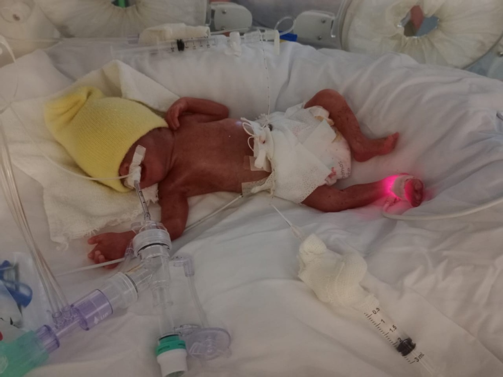 Por el fallecimiento de un bebé denuncian por presunta mala praxis al hospital municipal de Pigüé